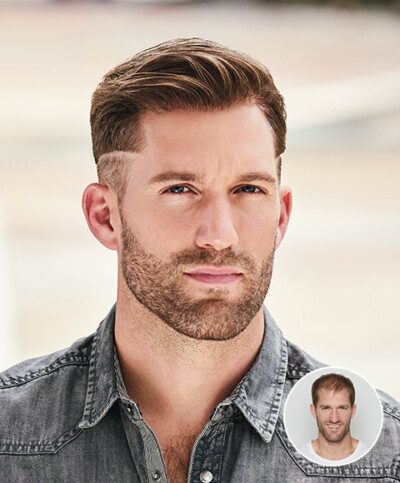 Men's hair replacement styling example with the original before inset