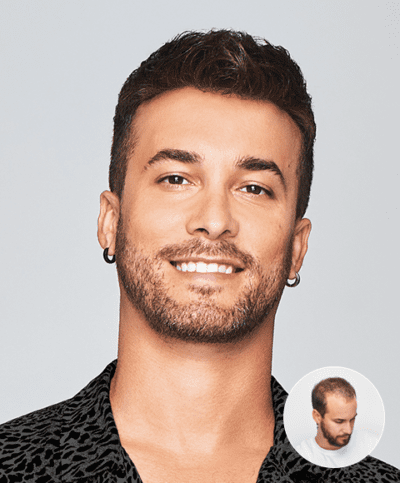 Men's American Hairlines style example with the original before inset