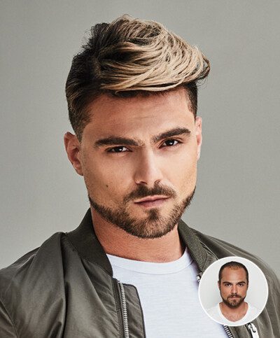 Hair replacement style example