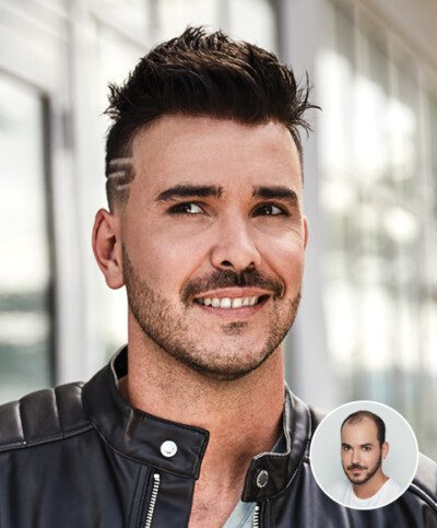 Women's hair replacement style example from the Hair Specialists gallery